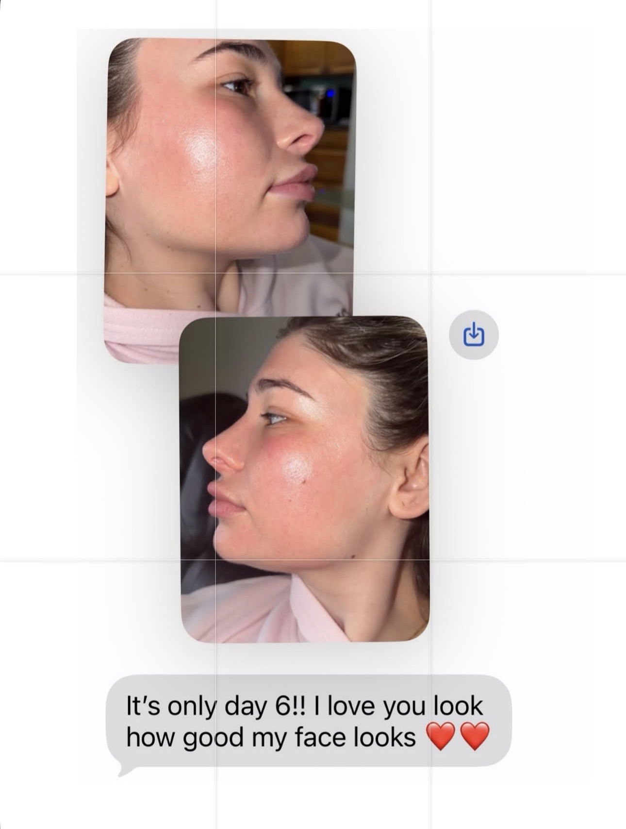 Client results showing a radiant, healthy glow after treatment